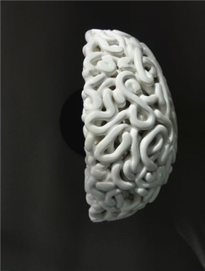 Cephalization | Oglavičenje